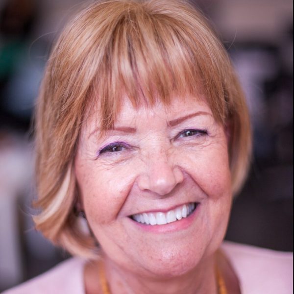 agnes_story-3 smiling female client with frontal fibrosing alopecia with short dark blonde hair loss system
