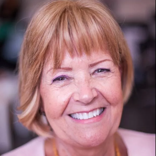 agnes_story-3 smiling female client with frontal fibrosing alopecia with short dark blonde hair loss system
