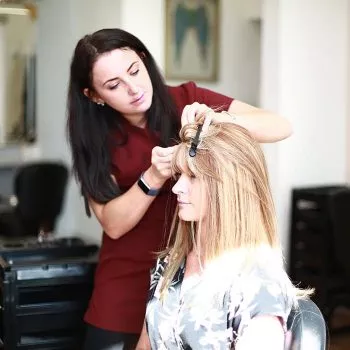 Trichotillomania client having hair system applied