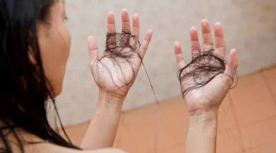 Female with hair falling out and hair in hands