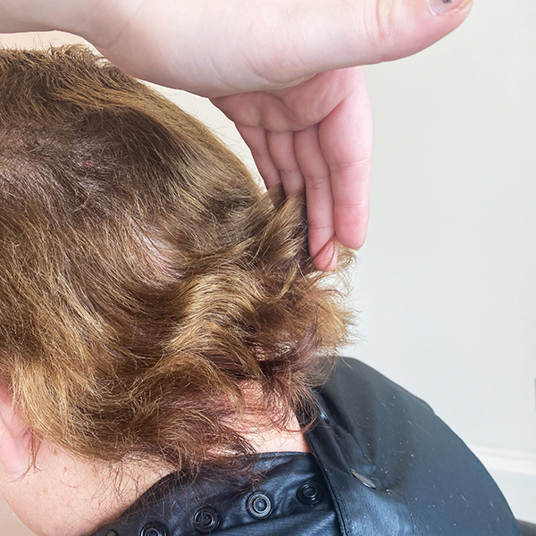 Female client with hair loss before the fitting of her enhancer system