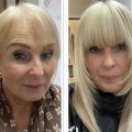Female client with thinning hair before and after the fitting of the Enhancer System