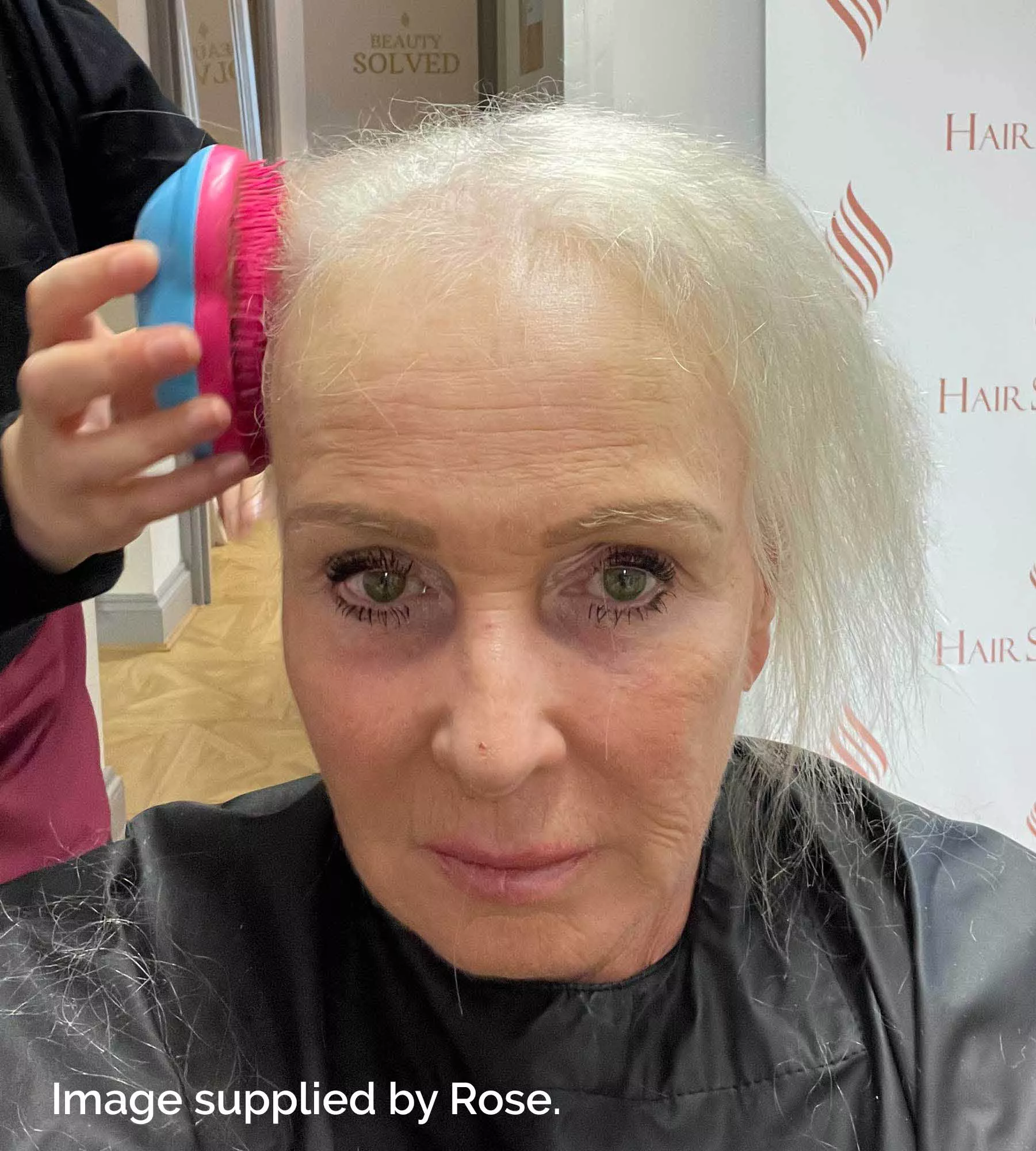 Rose at Hair Solved in Bristol before her system was fitted.